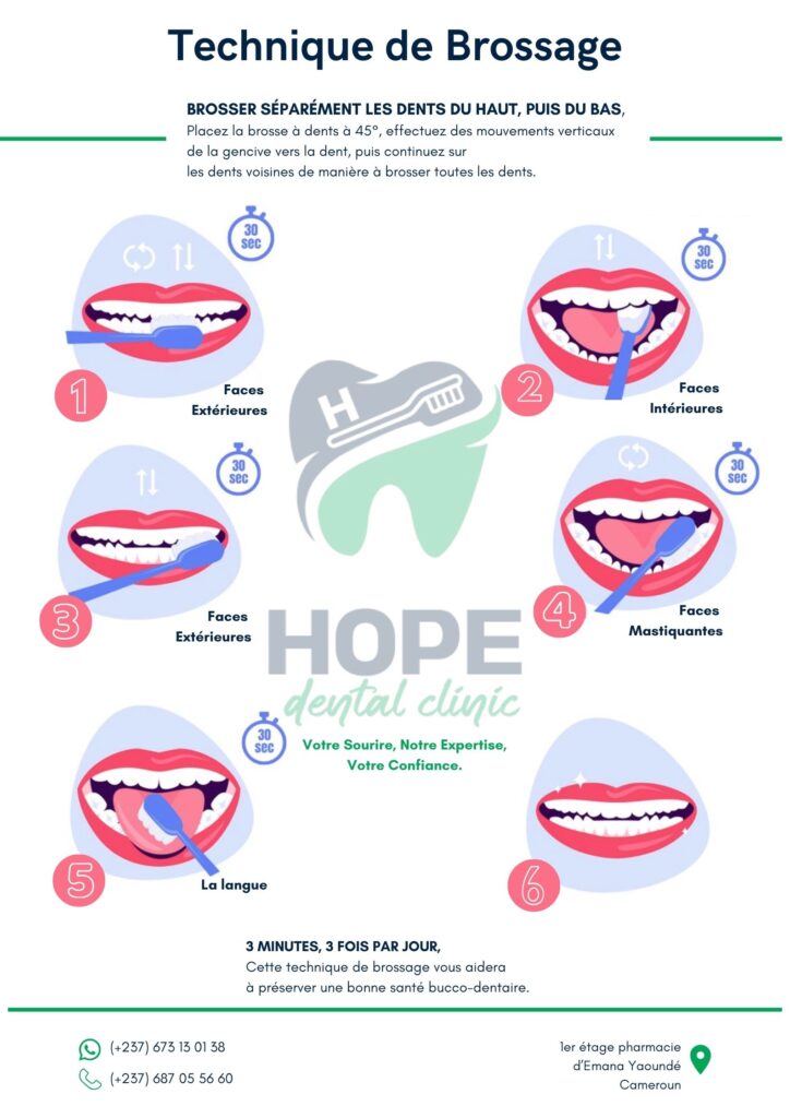 technique de brossage de dents